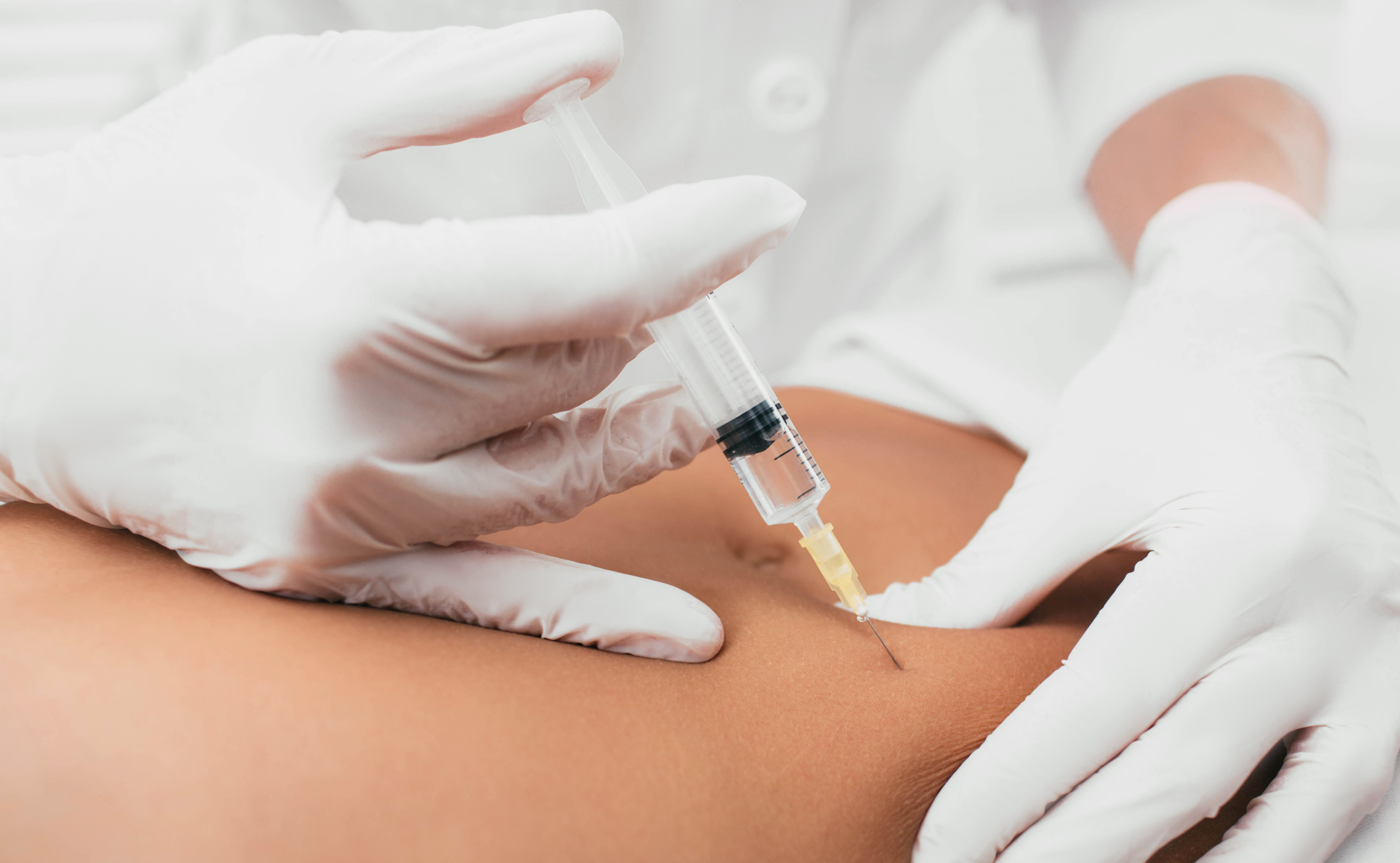 Stammzellentherapie bei Arthrose – Was Fettstammzellen für Ihr Gelenk leisten