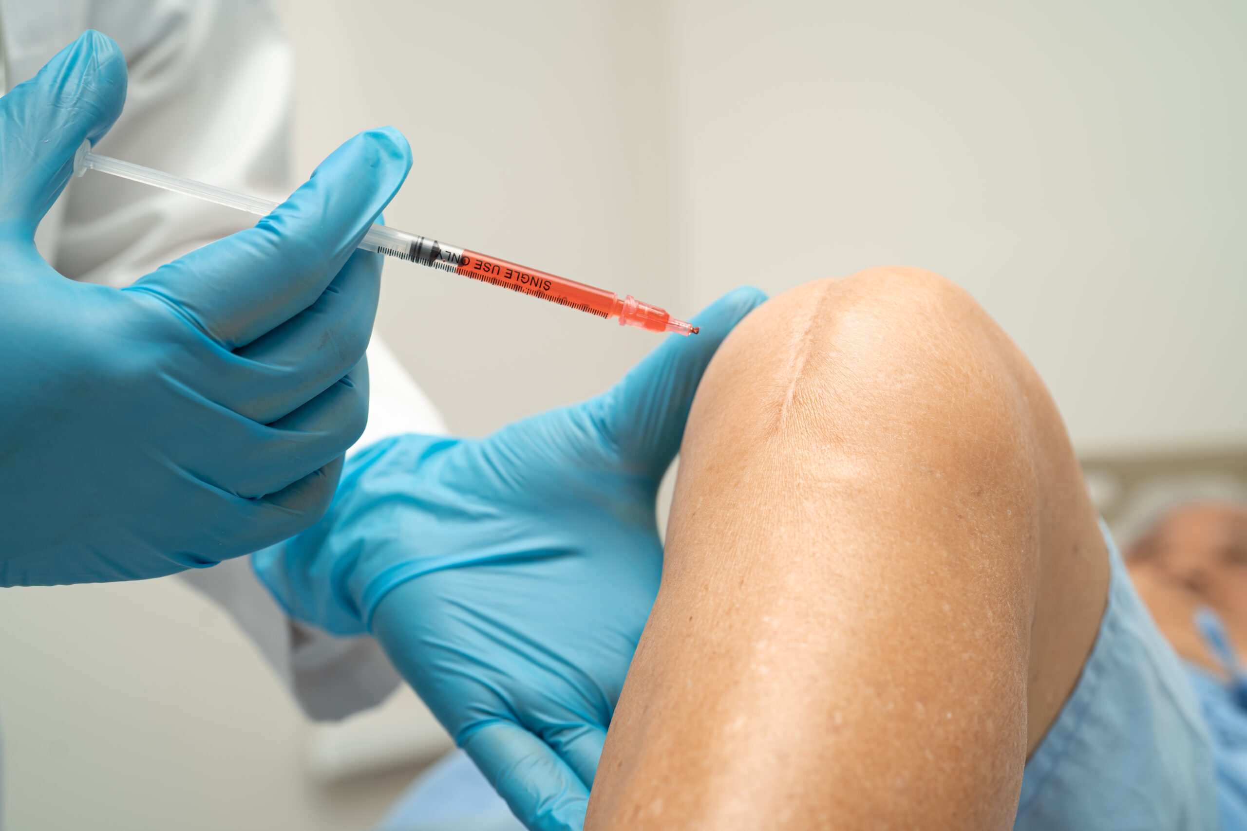 doctor inject Hyaluronic acid platelet rich plasma into the knee of senior woman to walk without pain.